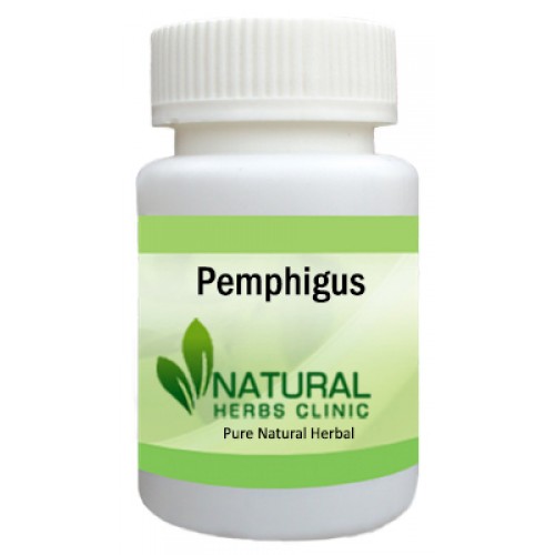 Herbal Supplements for Pemphigus
