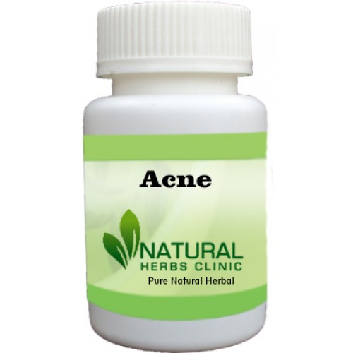 Herbal Supplements for Acne